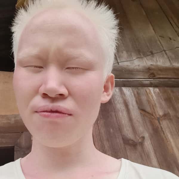 贵州残疾人帅哥真诚相亲找对象，山东征婚网